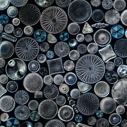 A microscopic photo of tiny diatoms